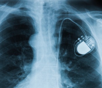 Pacemaker and Defibrillator Clinic